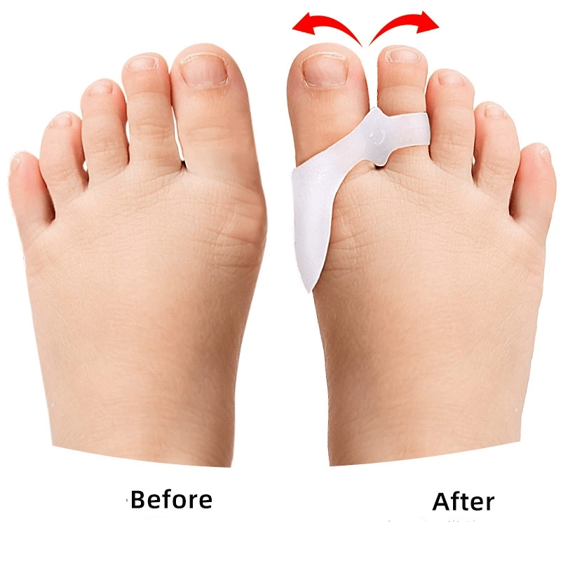 1/2/3 Pairs çocuk Jel Ayak Ayı - Toe Separator Silicon incelemesi ve fiyatı